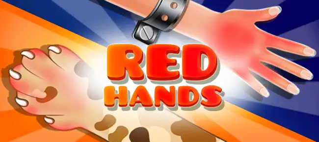 Red Hand Slap Game SellUnitySourceCode screenshot 3